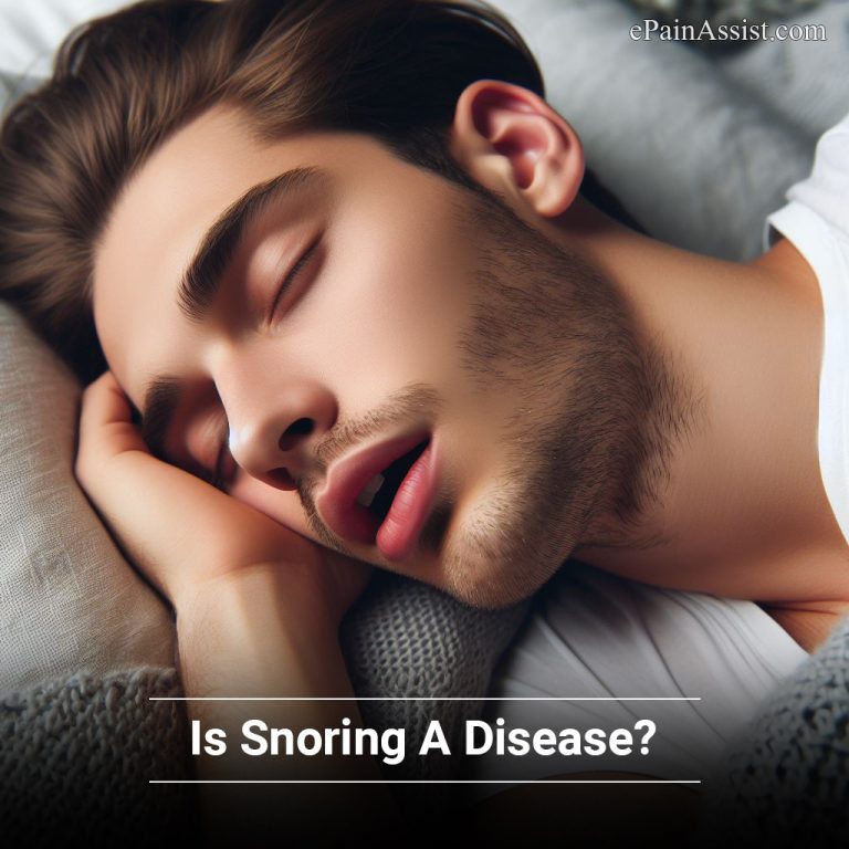 Is Snoring A Disease?|Causes & Complications of Snoring?| How Can Snoring Be Managed?
