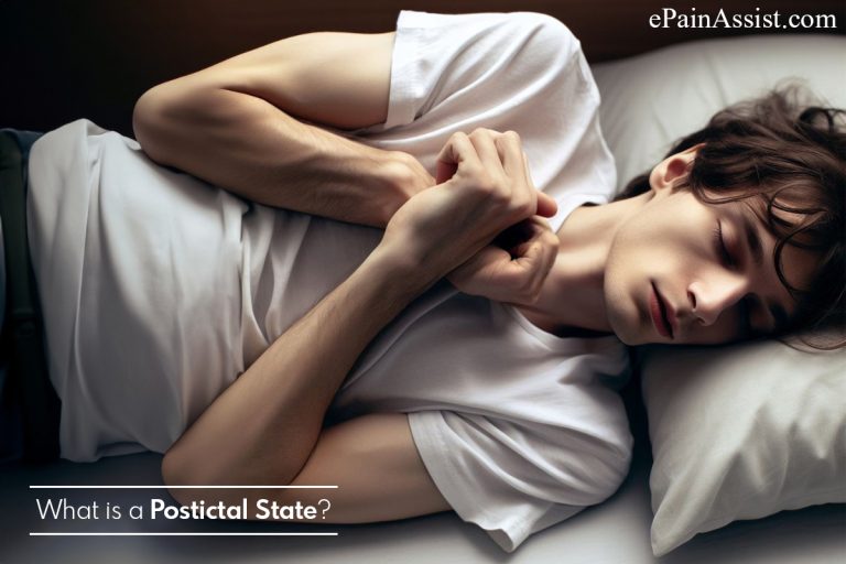 What is a Postictal State?