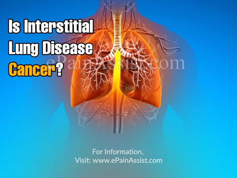 Is Interstitial Lung Disease Cancer?