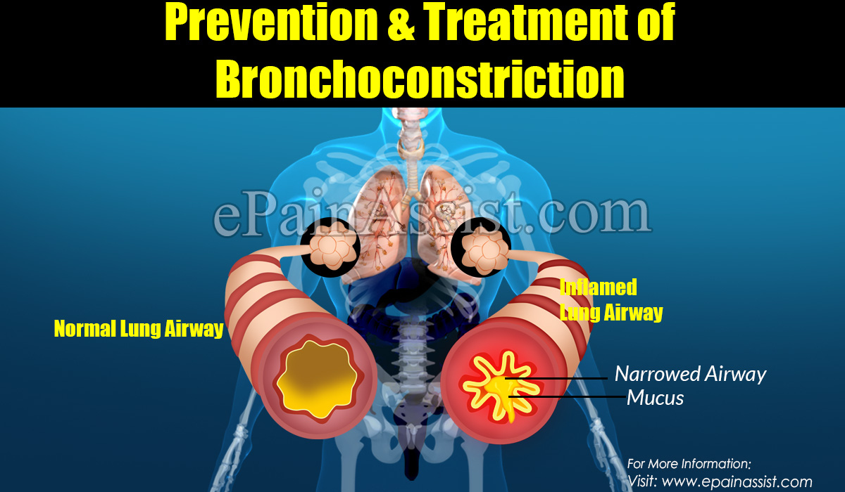 Prevention, Treatment & Complications of Bronchoconstriction