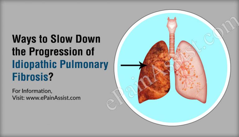How To Slow Down The Progression Of Idiopathic Pulmonary Fibrosis