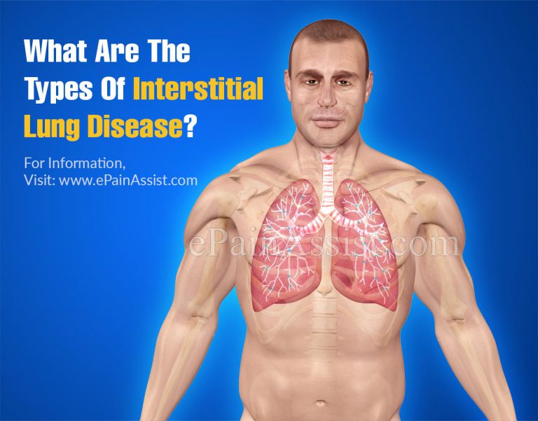 What Are The Types Of Interstitial Lung Disease?