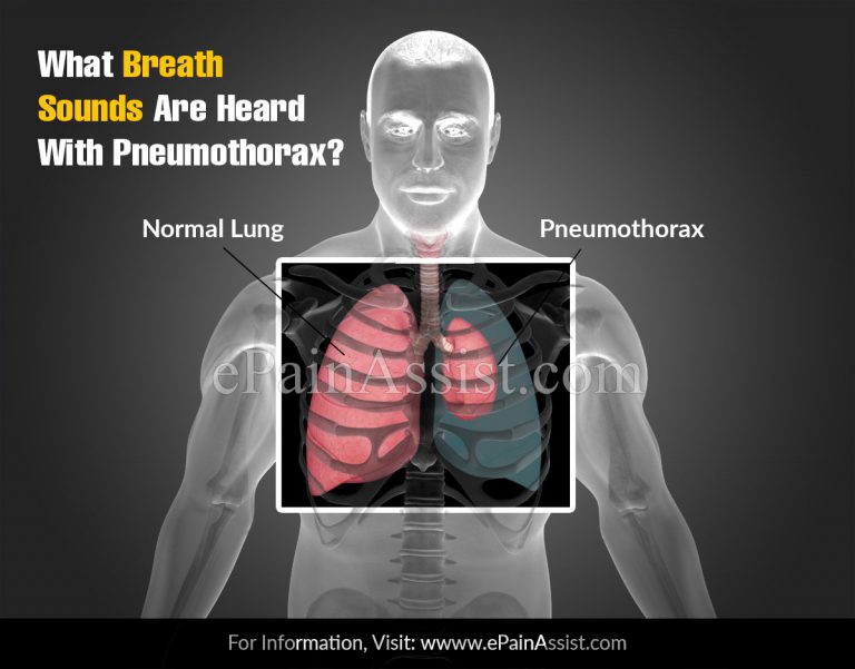 What Breath Sounds Are Heard With Pneumothorax?