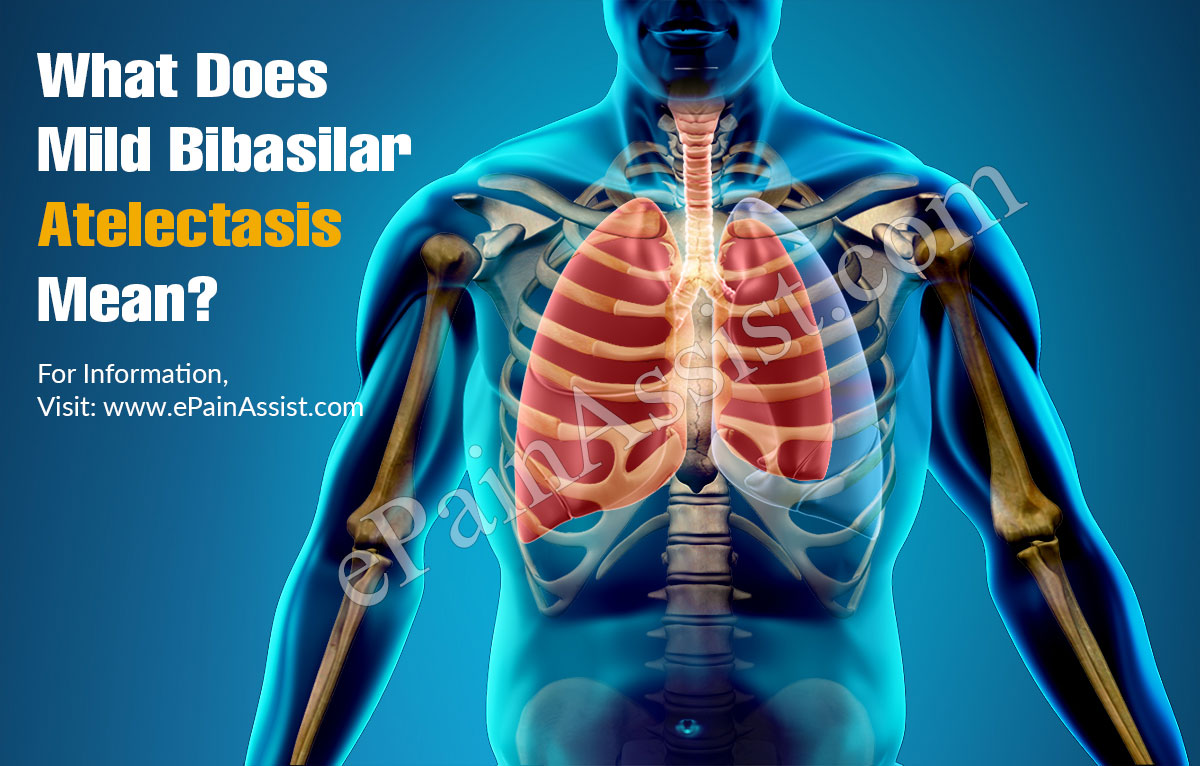 What Does Mild Bibasilar Atelectasis Mean?