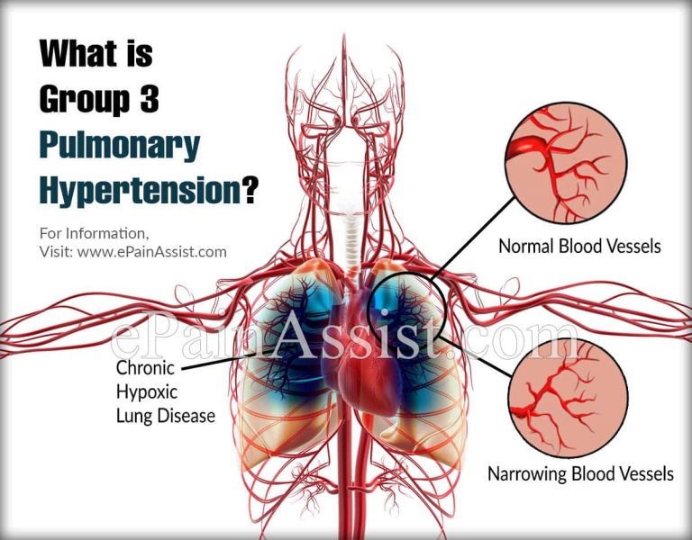 What is Group 3 Pulmonary Hypertension?