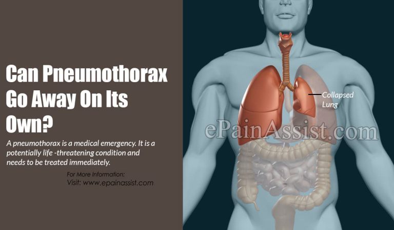 Can Pneumothorax Go Away On Its Own?