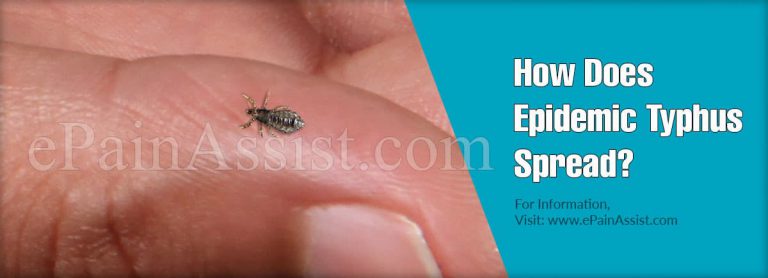 How Does Epidemic Typhus Spread & What Is The Incubation Period Of Epidemic Typhus?