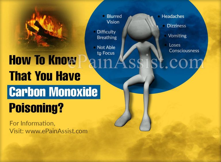 How To Know That You Have Carbon Monoxide Poisoning?