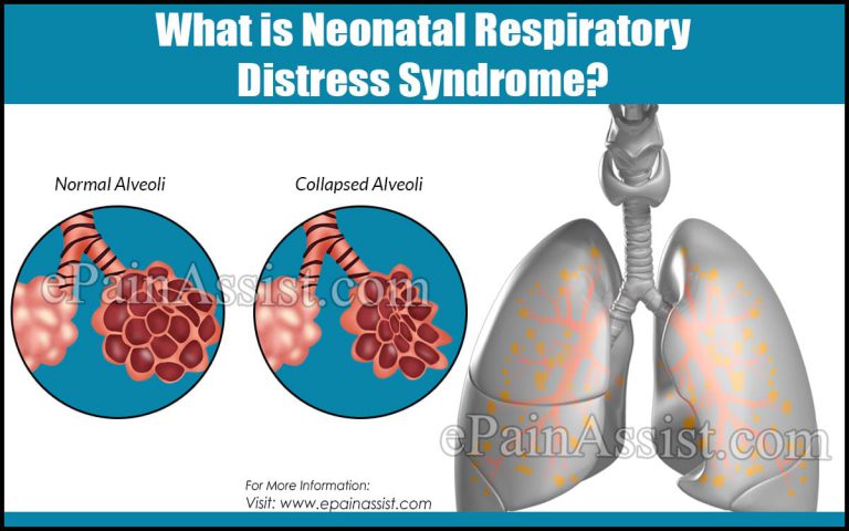 Neonatal Respiratory Distress Syndrome: Causes, Symptoms, Treatment, Prognosis, Diagnosis