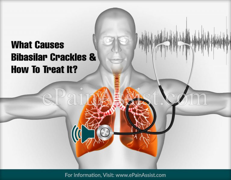 What Causes Bibasilar Crackles and How To Treat It?