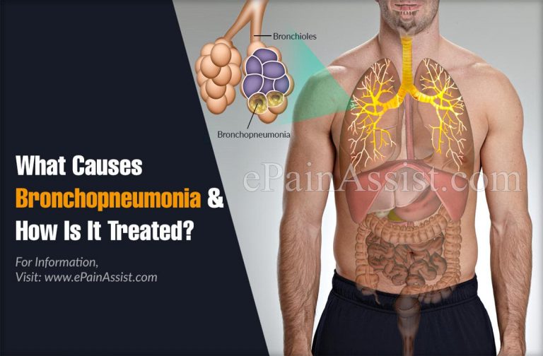 What Causes Bronchopneumonia & How Is It Treated?