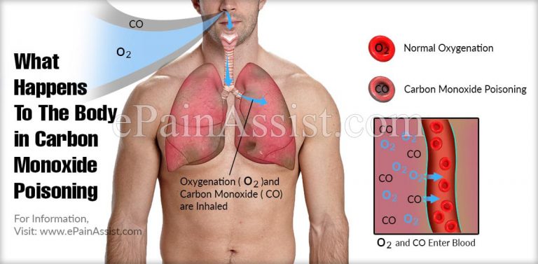 What Happens To The Body in Carbon Monoxide Poisoning & How to Treat It?