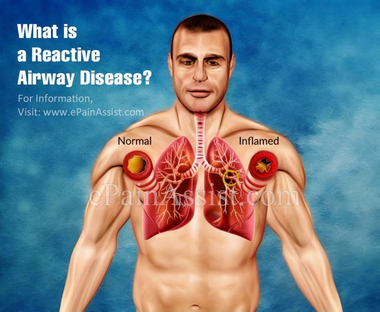 Causes And Presenting Features Of Reactive Airway Disease