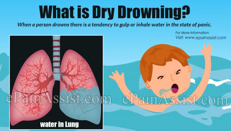 What is Dry Drowning, Know Its Symptoms, Treatment, Prevention