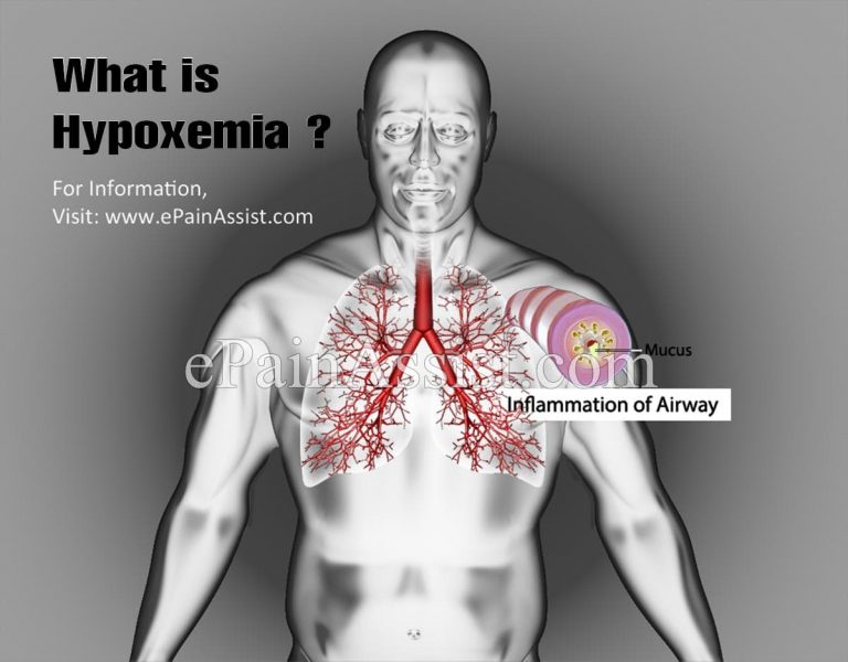 What is Hypoxemia & How Does It Differ From Hypoxia?|Types, Causes, Symptoms, Treatment of Hypoxemia