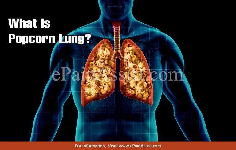 What is Popcorn Lung: Causes, Symptoms, Treatment, Diagnosis