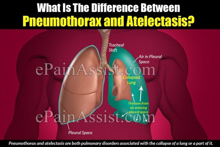 What Is The Difference Between Pneumothorax and Atelectasis?