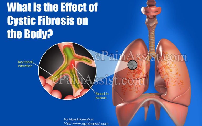 What is the Effect of Cystic Fibrosis on the Body & Importance of Diet and Nutrition in Cystic Fibrosis ?