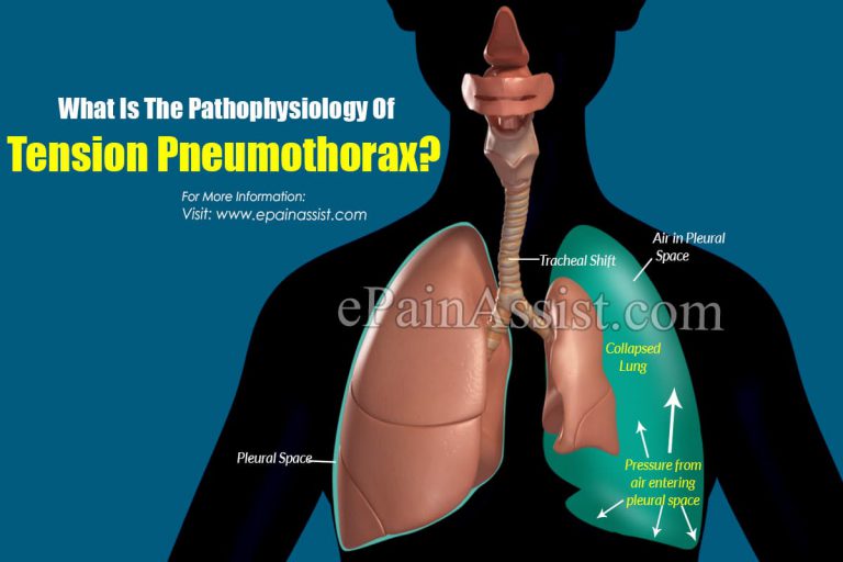 What Is The Pathophysiology Of Tension Pneumothorax?