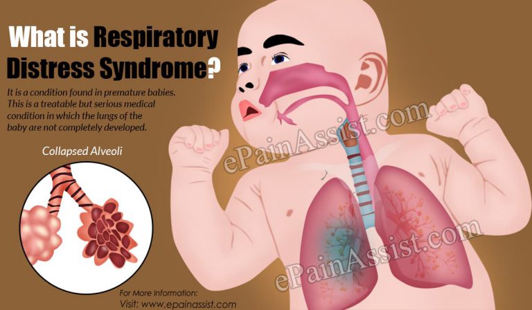 How Long Does Respiratory Distress Syndrome Last & Can Respiratory Failure Cause Death?