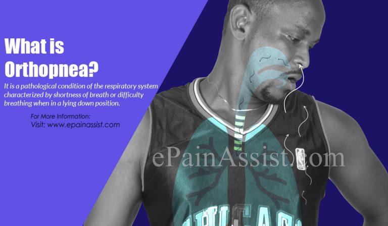 Orthopnea: Causes, Symptoms, Treatment