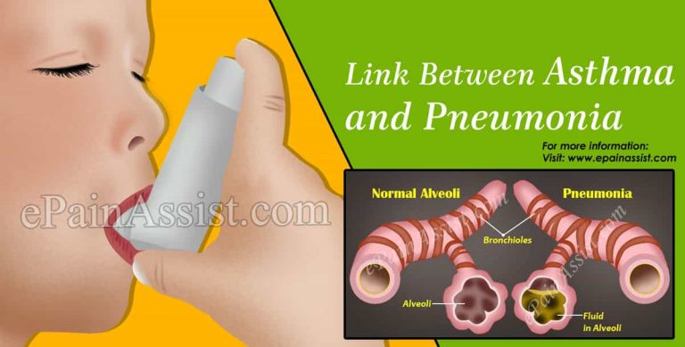Link Between Asthma and Pneumonia