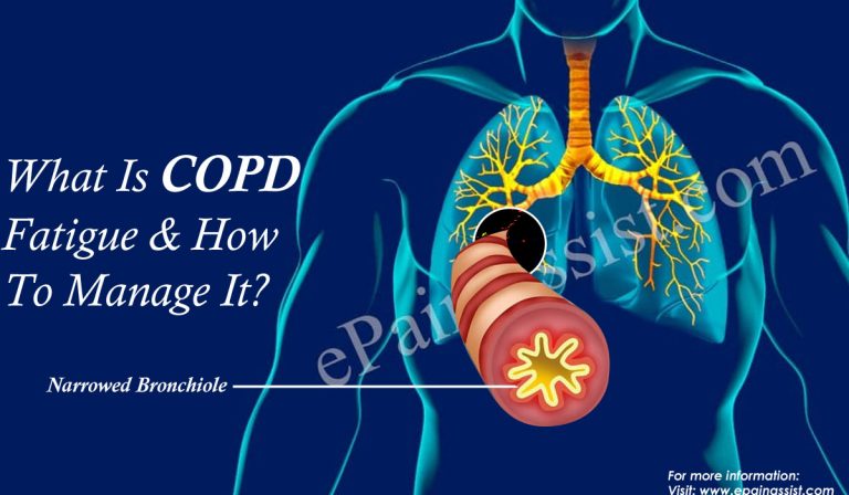 What Is COPD Fatigue & How To Manage It?