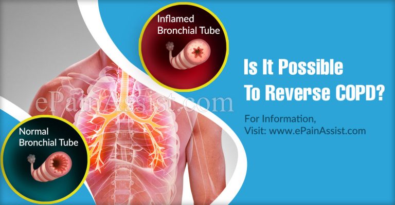 Is It Possible To Reverse COPD?