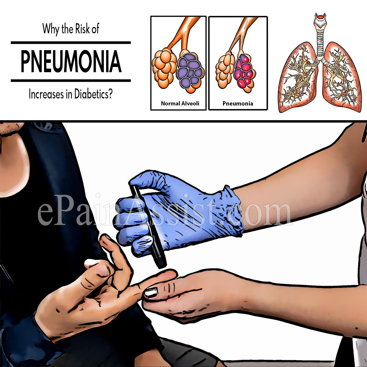 Why the Risk of Pneumonia Increases in Diabetics?