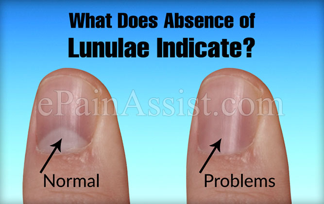 What Does Having Small Large Lanulae Or The Color Shape Of Lanulae 
