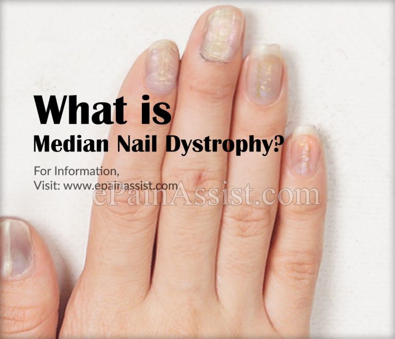 Median Nail Dystrophy: Causes, Symptoms, Treatment, Diagnosis