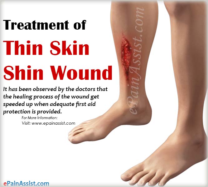 Treatment of Thin Skin Shin Wound