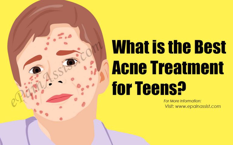 What is the Best Acne Treatment for Teens?