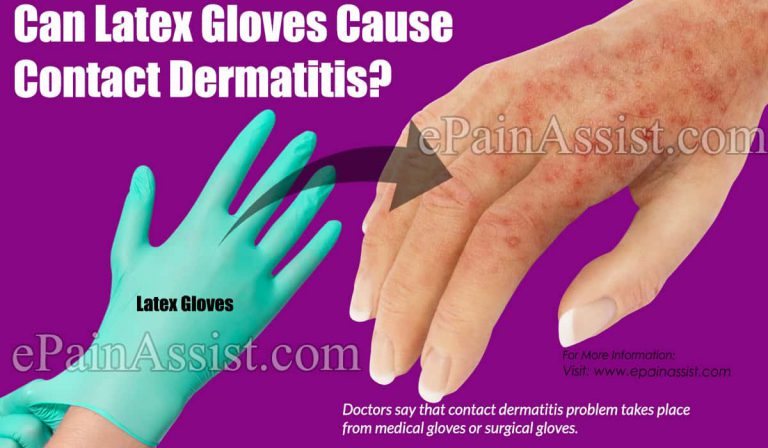 Can Latex Gloves Cause Contact Dermatitis?