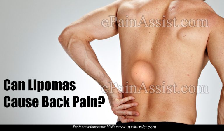 Can Lipomas Cause Back Pain?