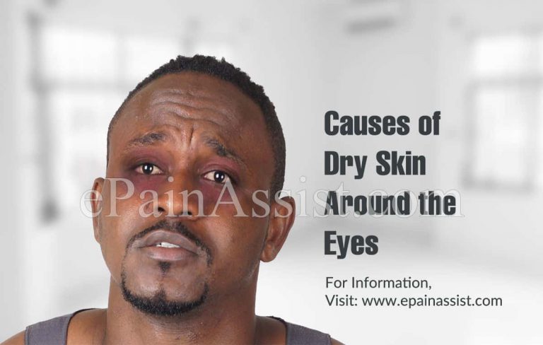 Causes of Dry Skin Around the Eyes & its Prevention, Treatment