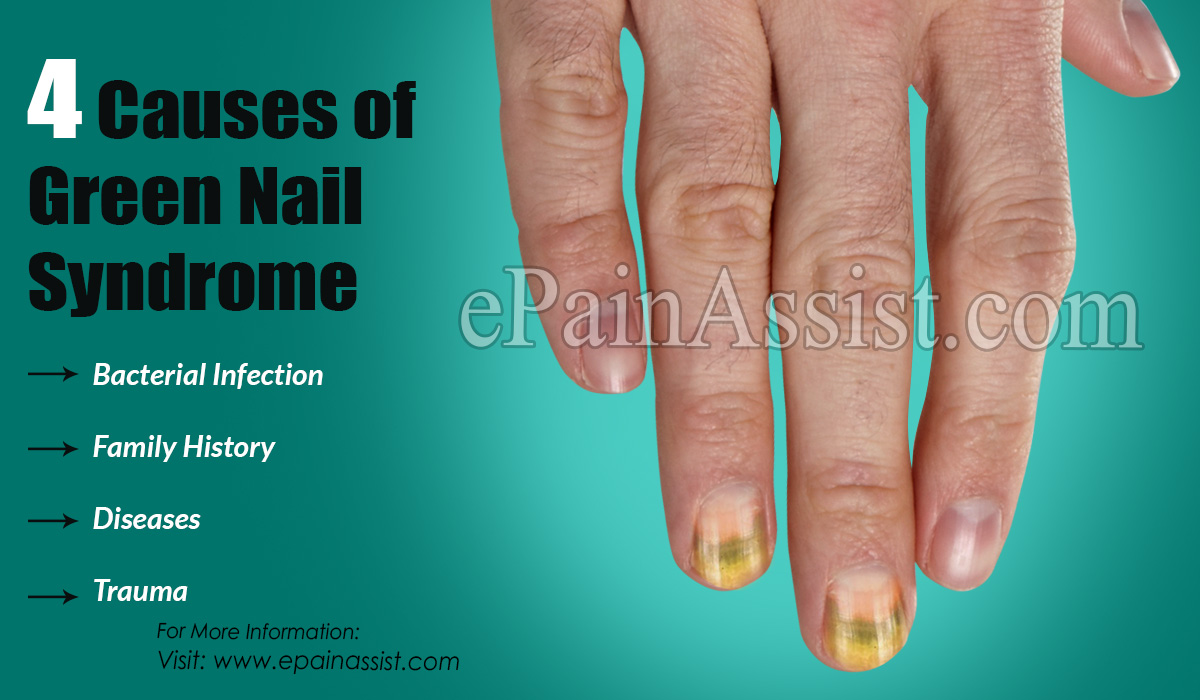 4 Causes of Green Nail Syndrome