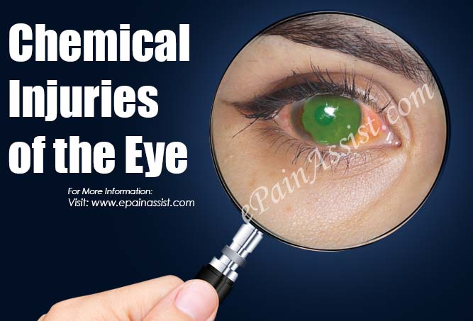 Chemical Injuries of the Eye