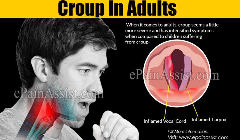 Croup In Adults: Causes, Symptoms, Treatments, Home Remedies, Prevention