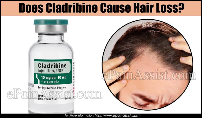 Does Cladribine Cause Hair Loss?