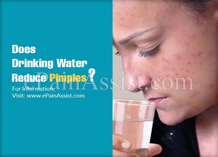 Does Drinking Water Reduce Pimples?