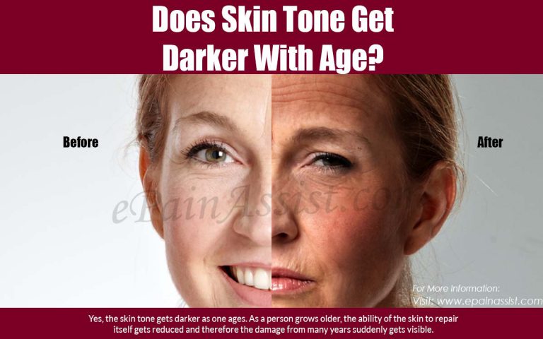 Does Skin Tone Get Darker with Age?