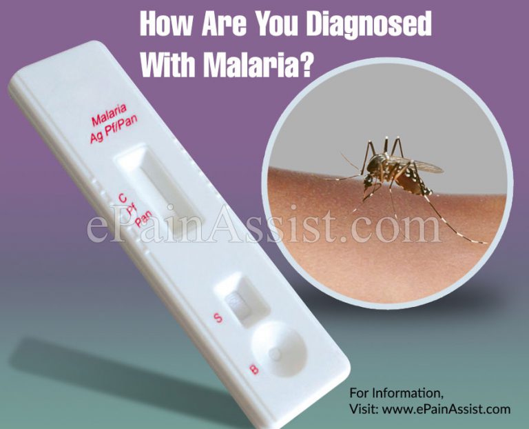 How Are You Diagnosed With Malaria?