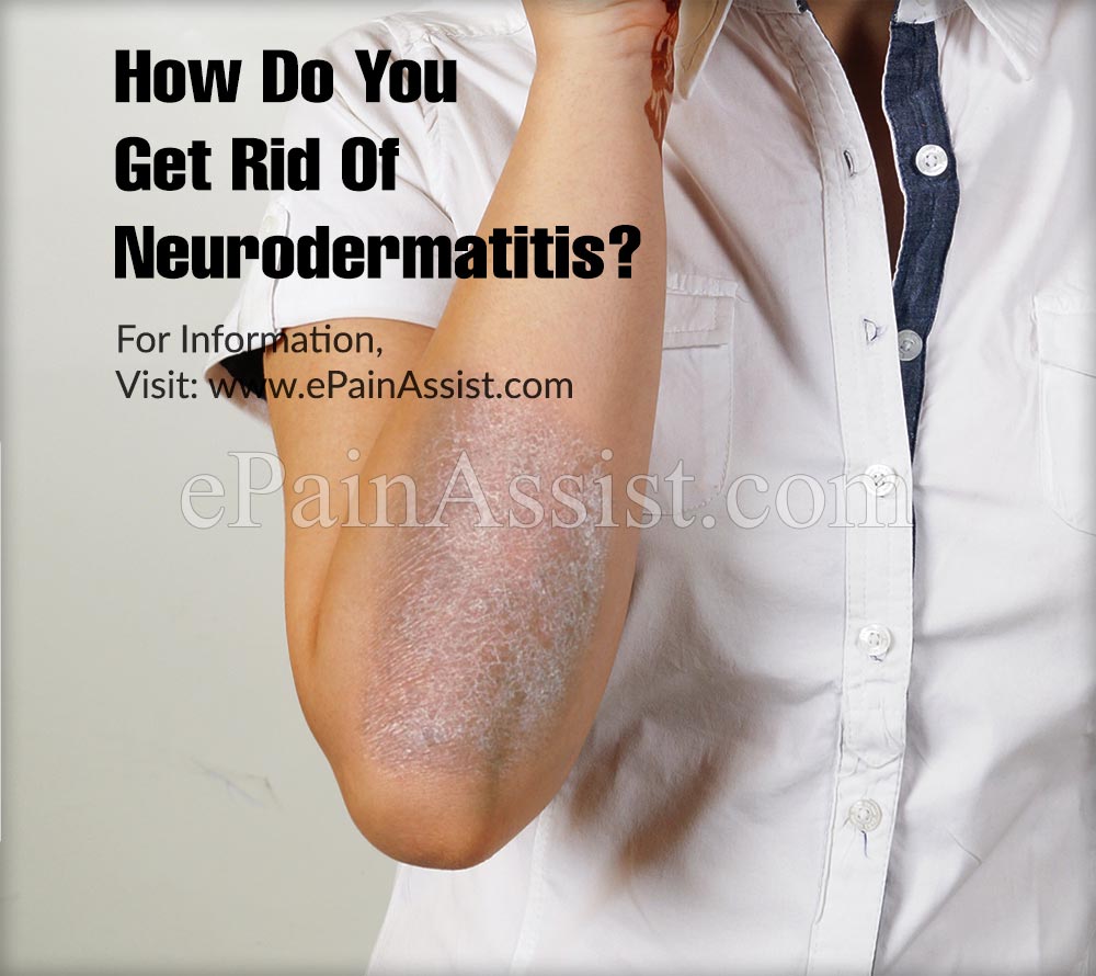 How Do You Get Rid Of Neurodermatitis?