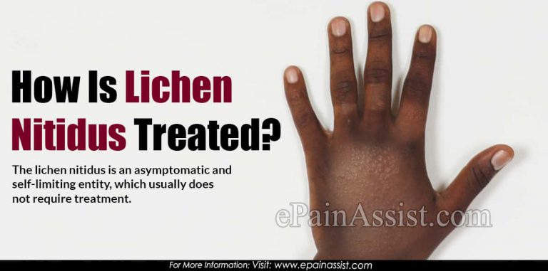 How Is Lichen Nitidus Treated?