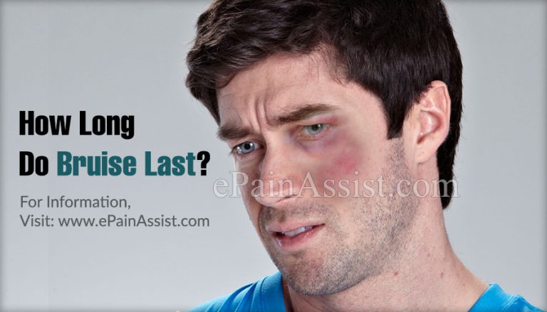 How Long Do Bruise Last?