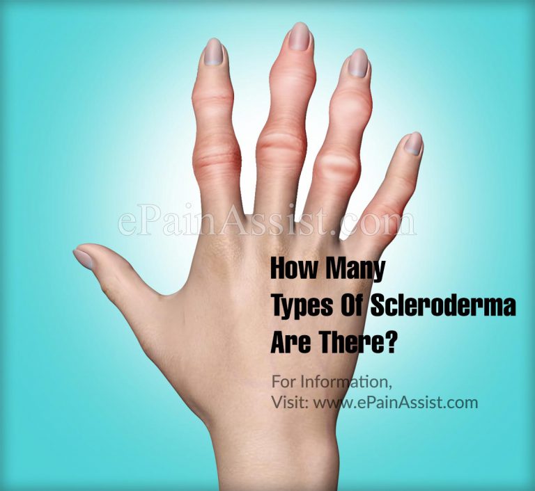 How Many Types Of Scleroderma Are There?
