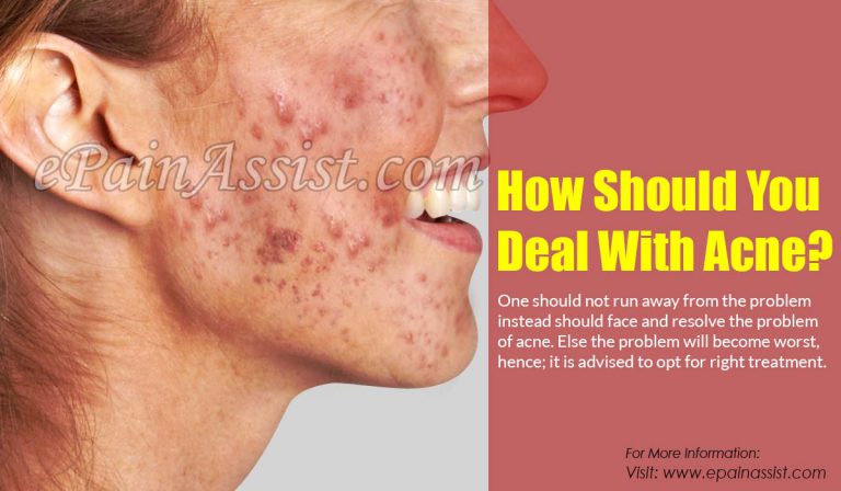 How Should You Deal With Acne?