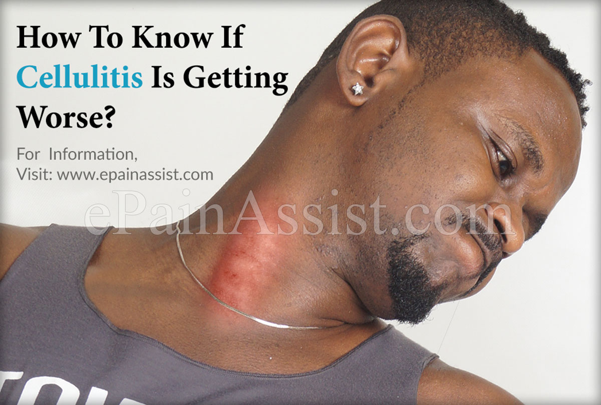 How To Know If Cellulitis Is Getting Worse?