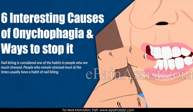 6 Interesting Causes of Onychophagia & Ways to stop it